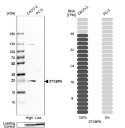 Amisyn Antibody, Novus Biologicals:Antibodies:Primary Antibodies